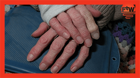 Elderly hands with a heated water bottle